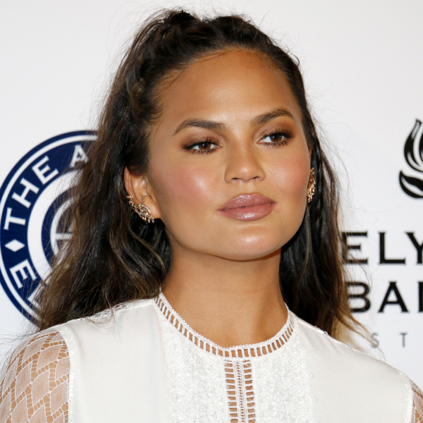 Chrissy Teigen about claim that she lost her tooth in a ...